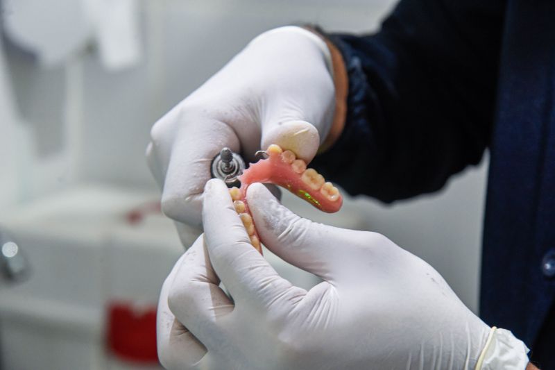 Serviços e entrega de Prótese no CEO