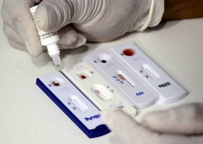 Ananindeua reforça diagnóstico precoce com mais de 75 mil testes rápidos para ISTs em 2025